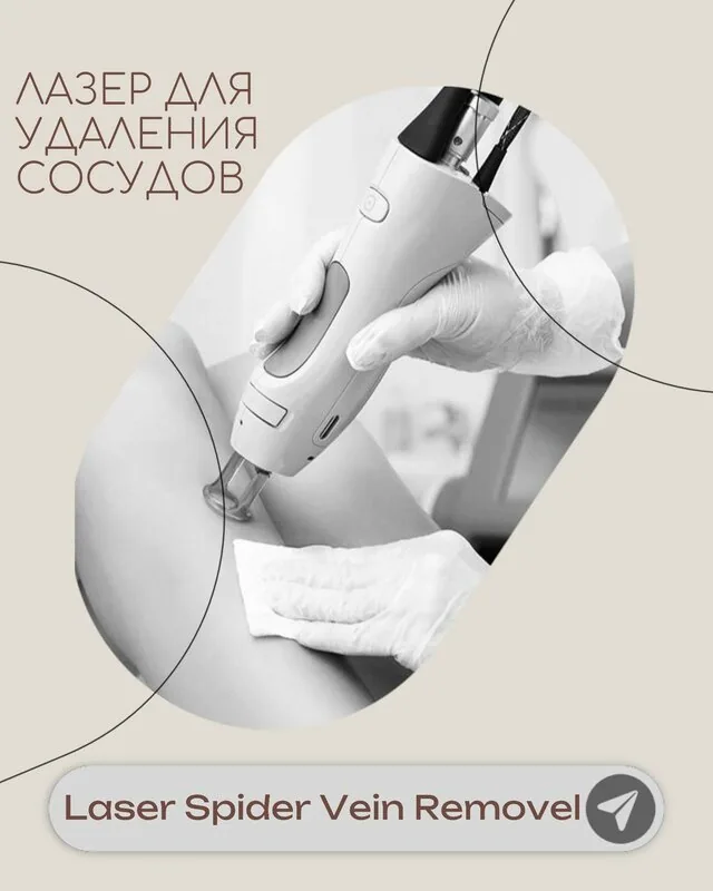 Акция: -40% на лазерное удаление сосудов